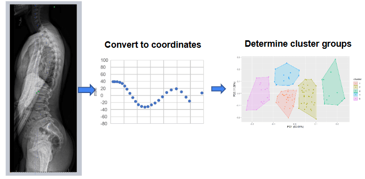 AI-Powered Spine Machine Learning Analysis